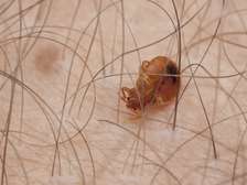 Bed bug fumigation services in kitengela contact number