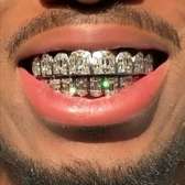 Sivler and gold teeth