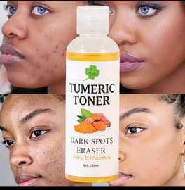 Turmeric Toner - Dark Spots Eraser