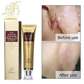 Deep scar and Acne mark removal Gel ointment