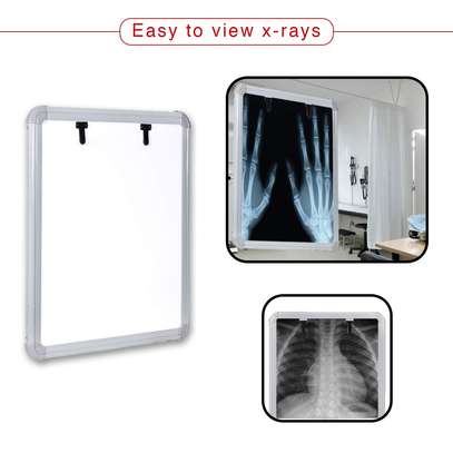 X-Ray Viewer Box (Single film) Price Kenya image 4