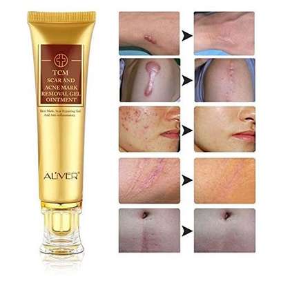 TCM SCAR AND ACNE MARK REMOVAL GEL OINTMENT image 3