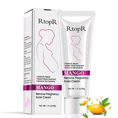 Rtopr Mango Remove Pregnancy Scars & Stretchmarks  Cream image 1