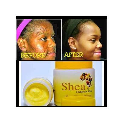 Shea Africa Raw African Shea Butter For Acne/Dandruff image 1