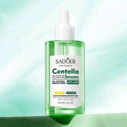 SADOER Acne Oil Control Face Serum image 2
