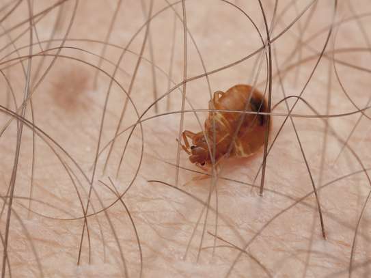 Best bed bug fumigation services in thika near me image 2