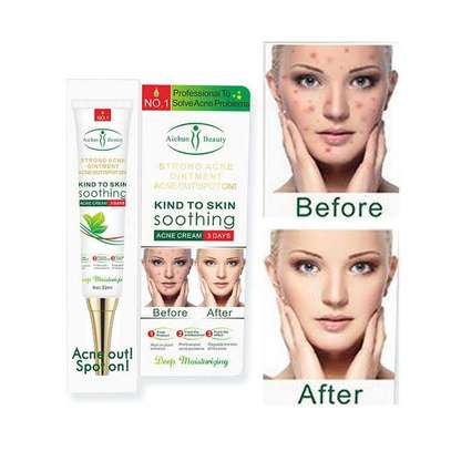 Aichun Beauty Kind To Skin Acne Ointment, 30g image 1
