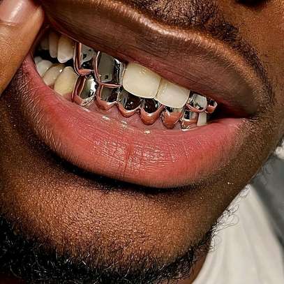 Sivler and gold teeth image 3