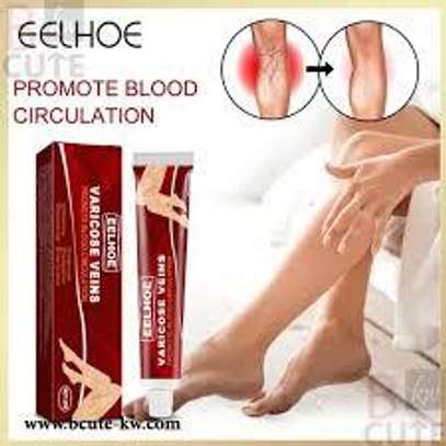 Varicose Veins Treatment Cream In  Kenya image 2