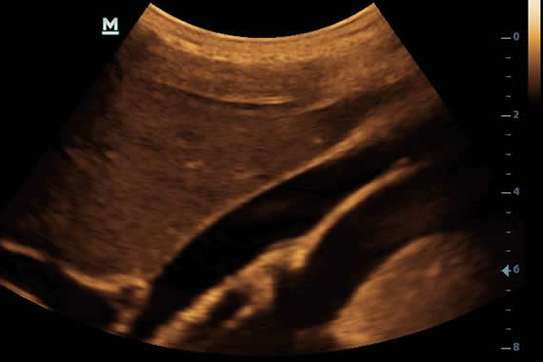 Mindray UltrasoundDP10 image 2