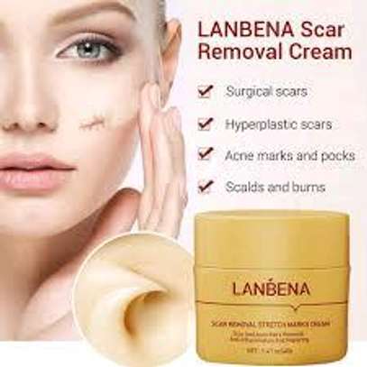 Lanbena scar remover stretchmarks cream image 1