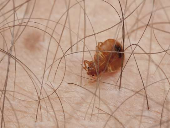 Bed Bug Pest Control Kiambu,Kitengela, Thindigua,Ruaka,Juja image 4