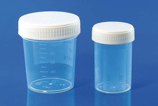 urine  container image 1