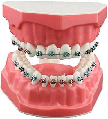 DENTAL BRACKETS LIGATURES O-RINGS FOR SALE IN KENYA image 2