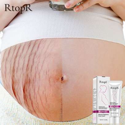 R TOP R PREGNANCY SCAR REMOVAL CREAM image 1