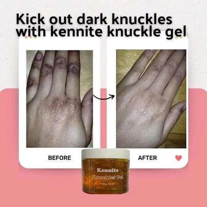 Kennite knuckle gel image 4