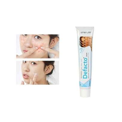 Defacto Anti Scar Snd Dark Spot Removal Cream image 1