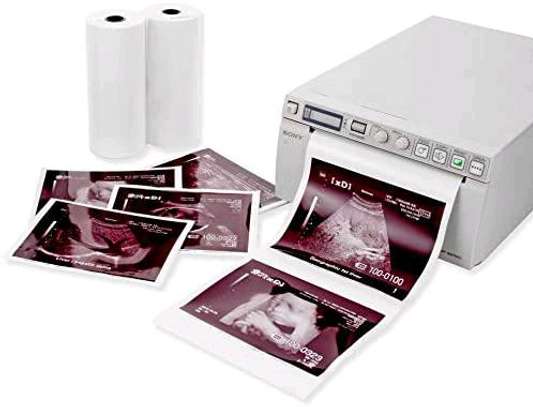Sony High Glossy Ultrasound Printing Paper Kenya image 2