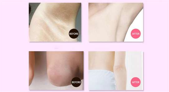 Aichun Beauty Whitening Cream For Sensitive Areas, 50g image 2
