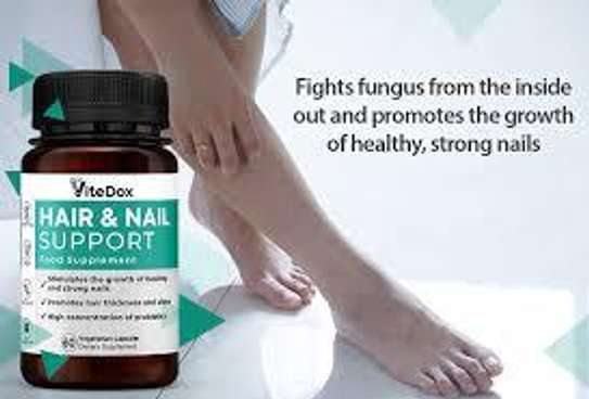 ViteDox Hair And Nail Support Food Supplement in Nairobi image 2