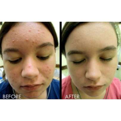 Dudu-Osun Black Soap-for Eczema,Acne, Skin,Dark Spots image 2