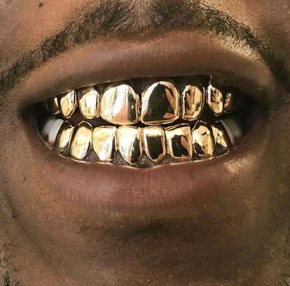 Sivler and gold teeth image 4