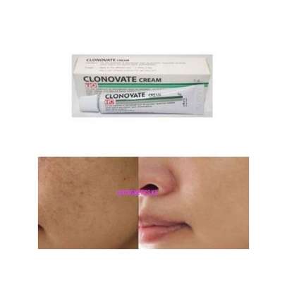 Clonovate Skin Lightening Cream-15g Very Effective.. image 1