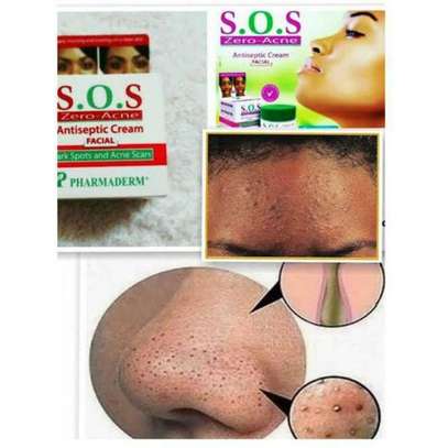 SOS Zero Acne Face Cream-Treats Acne,Pimples&Darkspots image 2