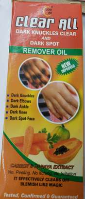 Clear All dark knuckles and dark spots removal oil image 1