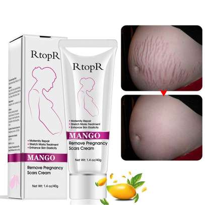Generic RtopR Pregnancy Stretch Marks Cream Scar Removal Cream Skin Care image 1