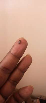 Bedbugs removal image 4