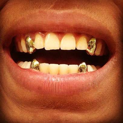 Silverine,,gold tooth caps image 2