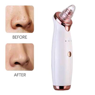Rechargeable black head remover with 6 heads image 1