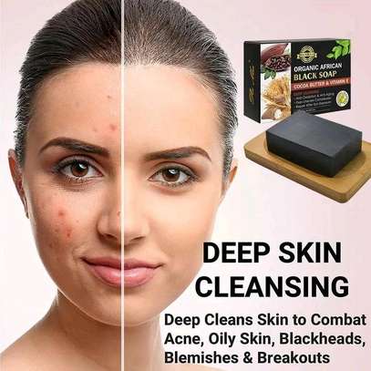 Organic African Vitamin E Black Soap Removes Acne Blemishes image 1
