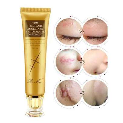 TCM Scar & Acne Mark Removal Gel Ointment image 1