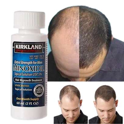 Kirkland Minoxidil For Hair Regrowth Minoxidil 5% image 1