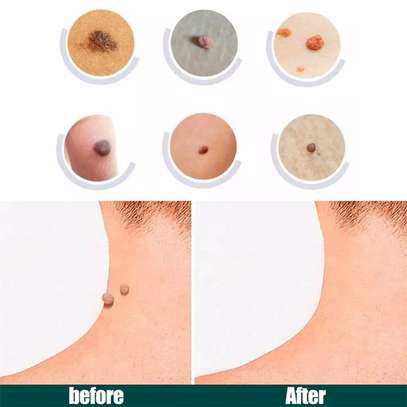 120pc/Skin Tag Removal Patches image 2