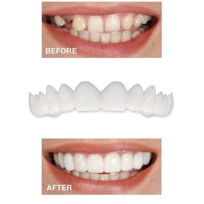 DENTAL CERAMICS 11 FOR SALE PRICES NAIROBI,KENYA image 4