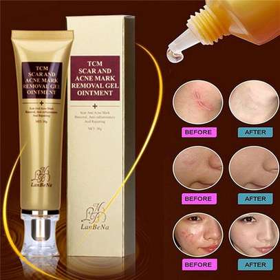 TCM Scar & Acne Mark Removal Gel Ointment image 2