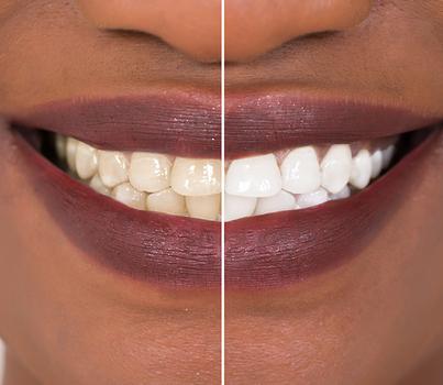 Oak Dental Clinic banner