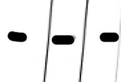 Teren de 20000 mp, în Dragalina - 4